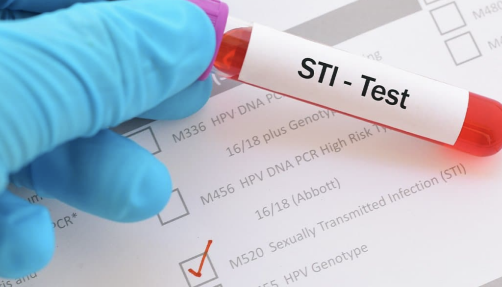 Gov’t urges residents to ‘wrap it up’ as STI cases increase